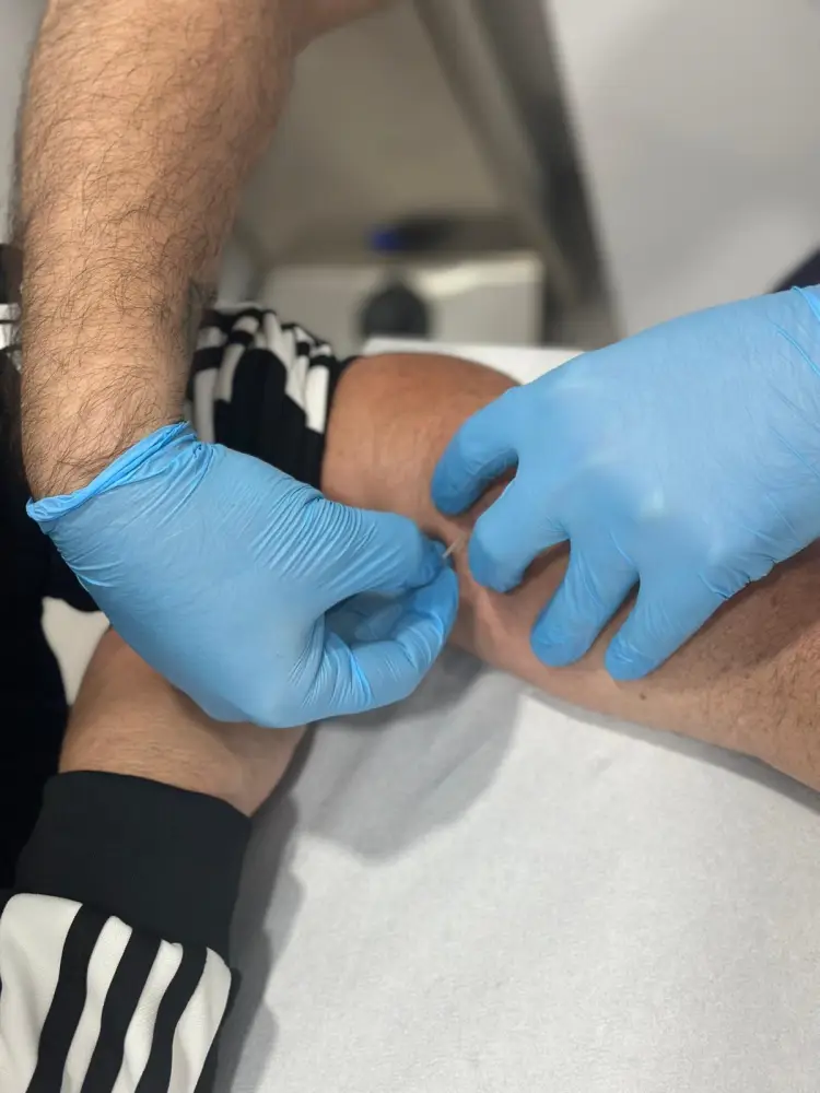 Terapia manual en DM Fisioterapia